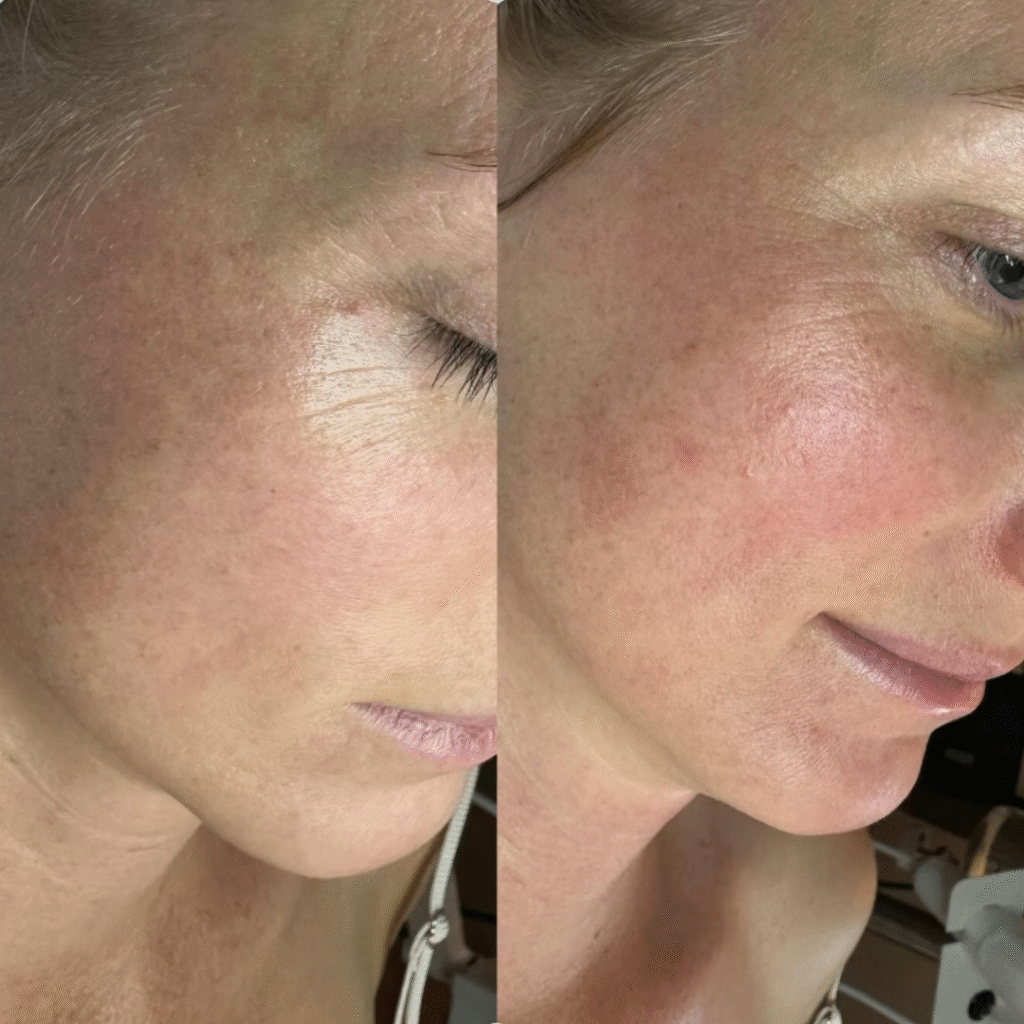 Optimized with keyphrase, describing the visible result (clarity, glow, texture, lines, radiance).